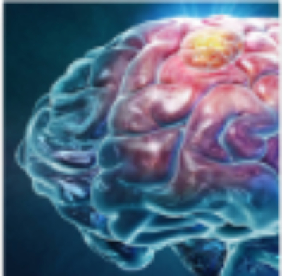 Brain-Tumor-Program-Main-Image (3)
